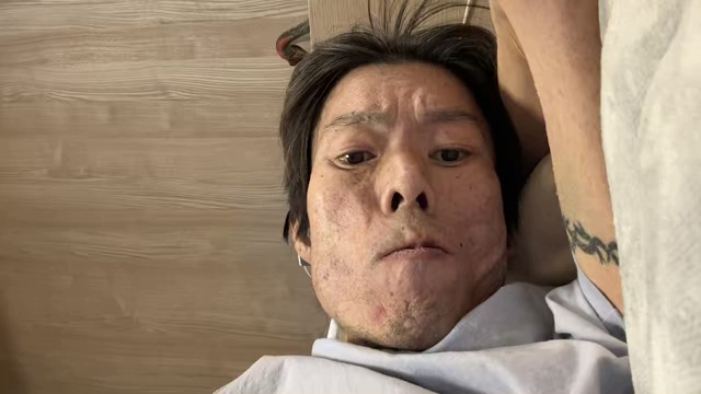 金バエの配信のサムネイル画像