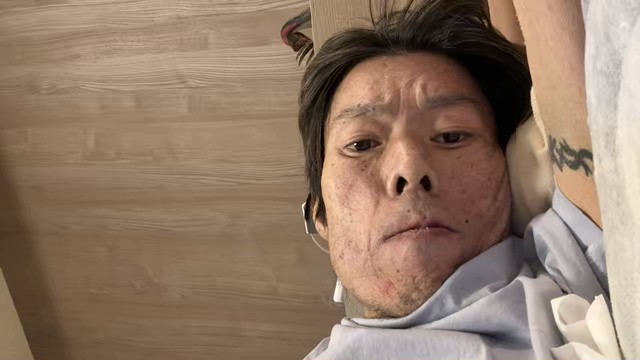 金バエの配信のサムネイル画像