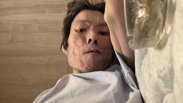 金バエの配信のサムネイル画像