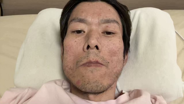 金バエの配信のサムネイル画像