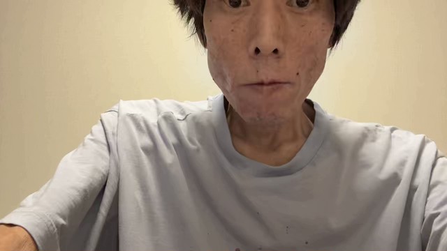 金バエの配信のサムネイル画像
