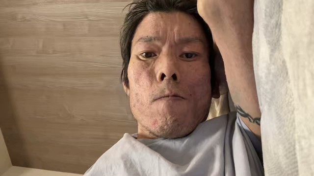 金バエの配信のサムネイル画像