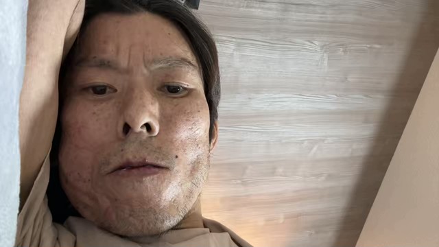 金バエの配信のサムネイル画像