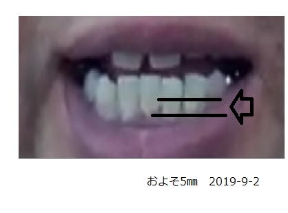 ひさしぶりに　計測