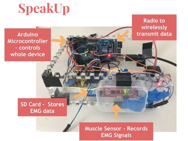 SpeakUp: Silent Speech Interface; Low Cost; Arduin